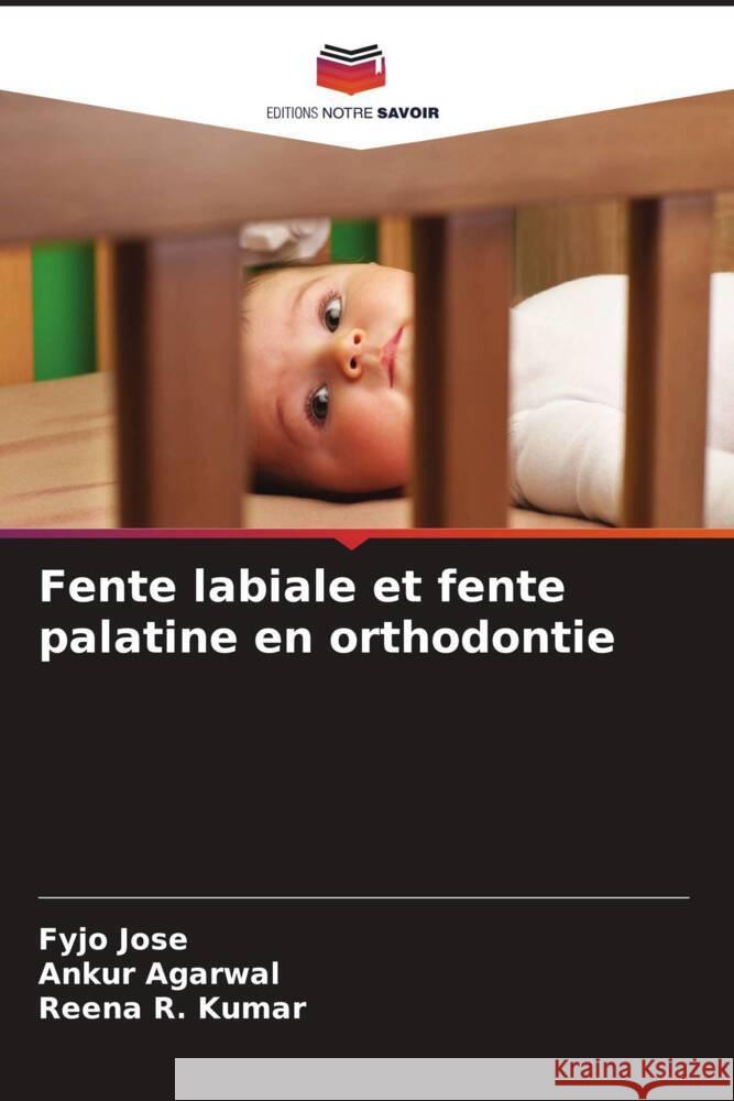 Fente labiale et fente palatine en orthodontie Jose, Fyjo, Agarwal, Ankur, Kumar, Reena R. 9786204486383 Editions Notre Savoir