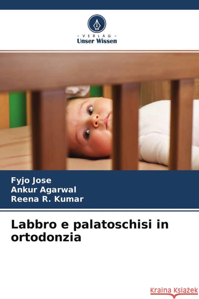 Labbro e palatoschisi in ortodonzia Jose, Fyjo, Agarwal, Ankur, Kumar, Reena R. 9786204486390 Verlag Unser Wissen