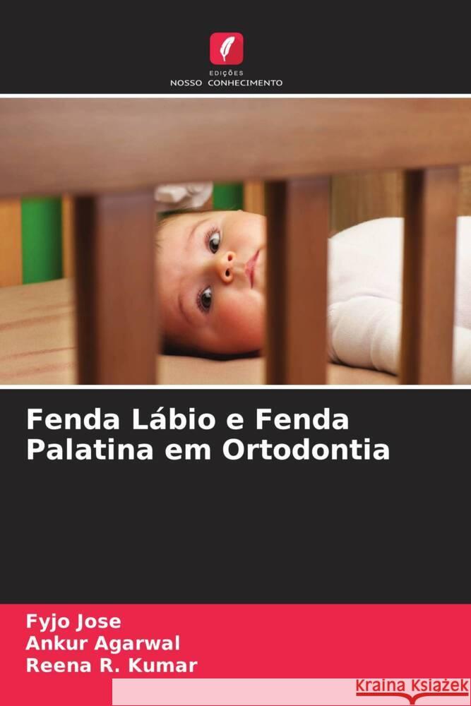 Fenda Lábio e Fenda Palatina em Ortodontia Jose, Fyjo, Agarwal, Ankur, Kumar, Reena R. 9786204486406 Edições Nosso Conhecimento