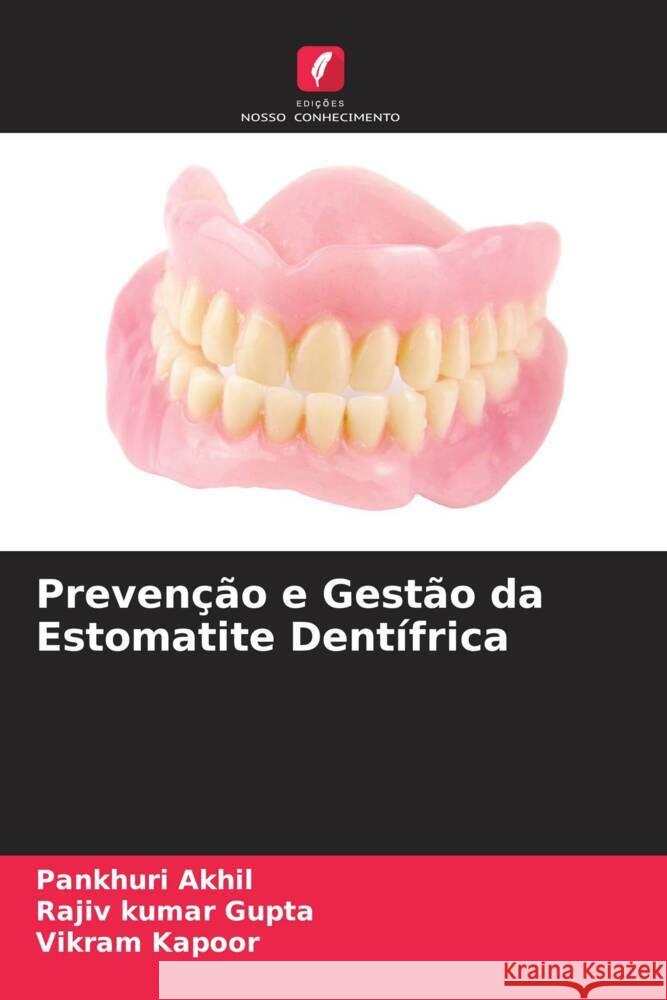 Prevenção e Gestão da Estomatite Dentífrica Akhil, Pankhuri, Gupta, Rajiv kumar, Kapoor, Vikram 9786204493077