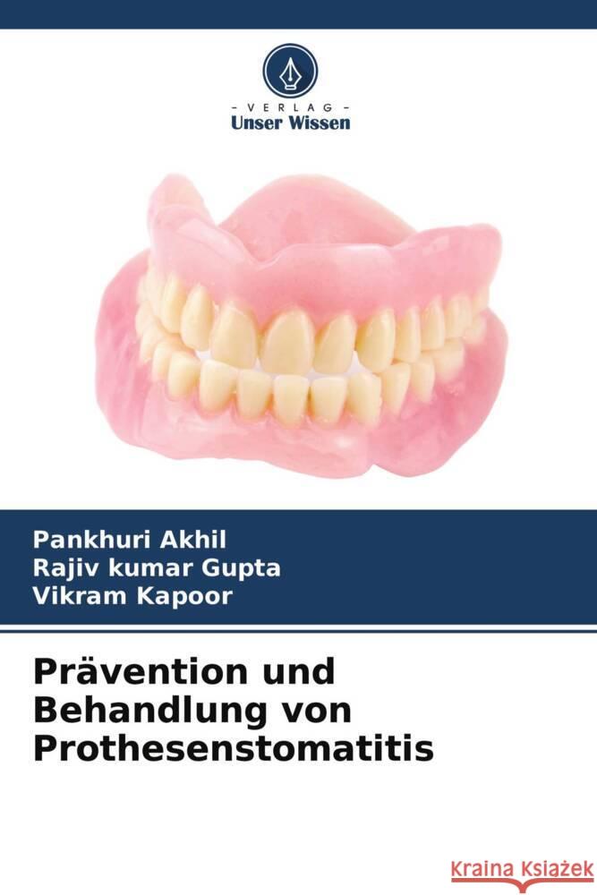 Prävention und Behandlung von Prothesenstomatitis Akhil, Pankhuri, Gupta, Rajiv kumar, Kapoor, Vikram 9786204493091