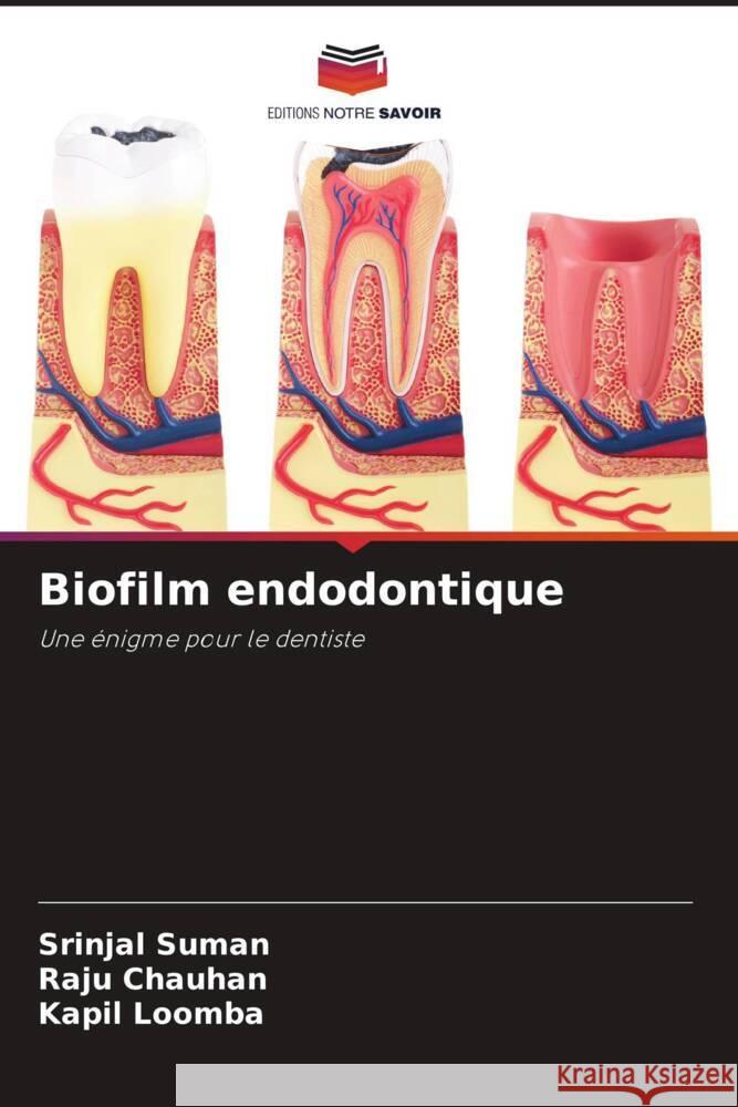 Biofilm endodontique Suman, Srinjal, Chauhan, Raju, Loomba, Kapil 9786204493763 Editions Notre Savoir