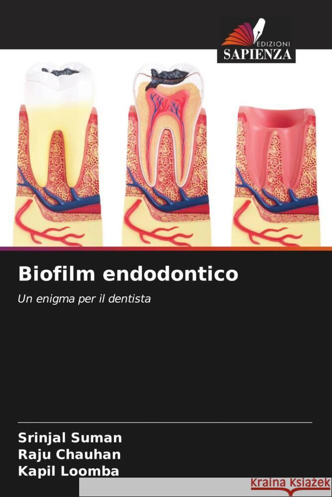 Biofilm endodontico Suman, Srinjal, Chauhan, Raju, Loomba, Kapil 9786204493770 Edizioni Sapienza