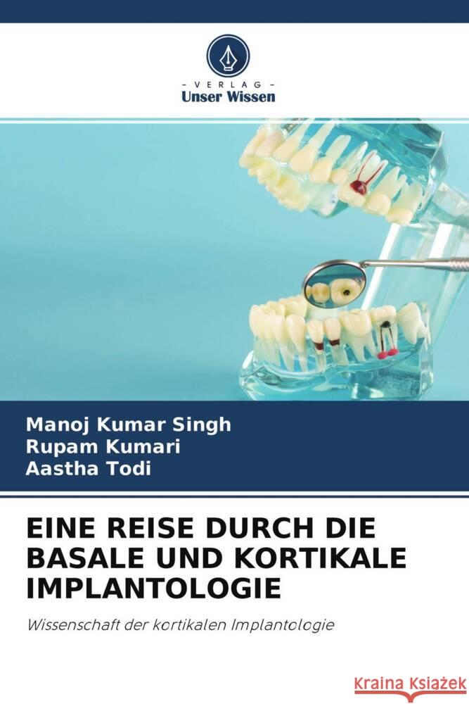 EINE REISE DURCH DIE BASALE UND KORTIKALE IMPLANTOLOGIE Singh, Manoj Kumar, Kumari, Rupam, Todi, Aastha 9786204495927 Verlag Unser Wissen