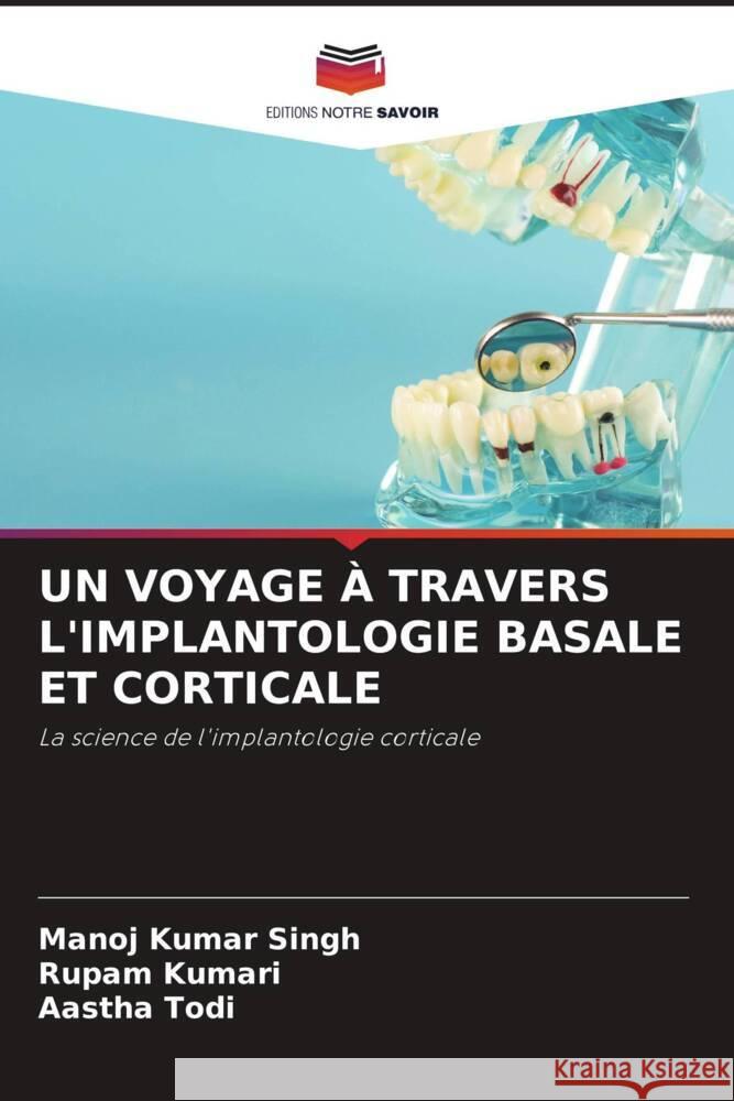 UN VOYAGE À TRAVERS L'IMPLANTOLOGIE BASALE ET CORTICALE Singh, Manoj Kumar, Kumari, Rupam, Todi, Aastha 9786204495958 Editions Notre Savoir