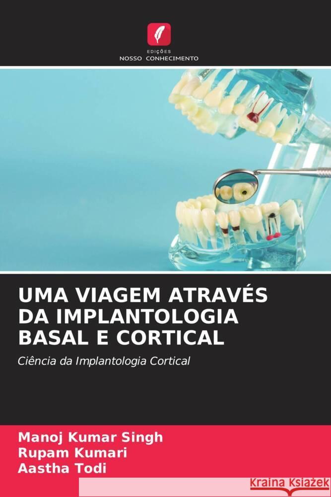 UMA VIAGEM ATRAVÉS DA IMPLANTOLOGIA BASAL E CORTICAL Singh, Manoj Kumar, Kumari, Rupam, Todi, Aastha 9786204495965 Edições Nosso Conhecimento