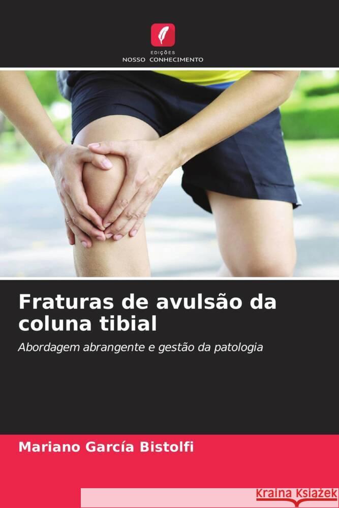 Fraturas de avulsão da coluna tibial García Bistolfi, Mariano 9786204504674 Edições Nosso Conhecimento