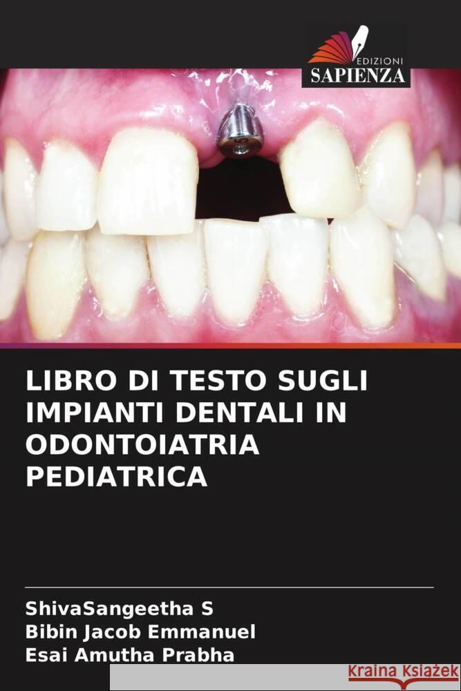 LIBRO DI TESTO SUGLI IMPIANTI DENTALI IN ODONTOIATRIA PEDIATRICA S, ShivaSangeetha, Emmanuel, Bibin Jacob, Prabha, Esai Amutha 9786204509006 Edizioni Sapienza