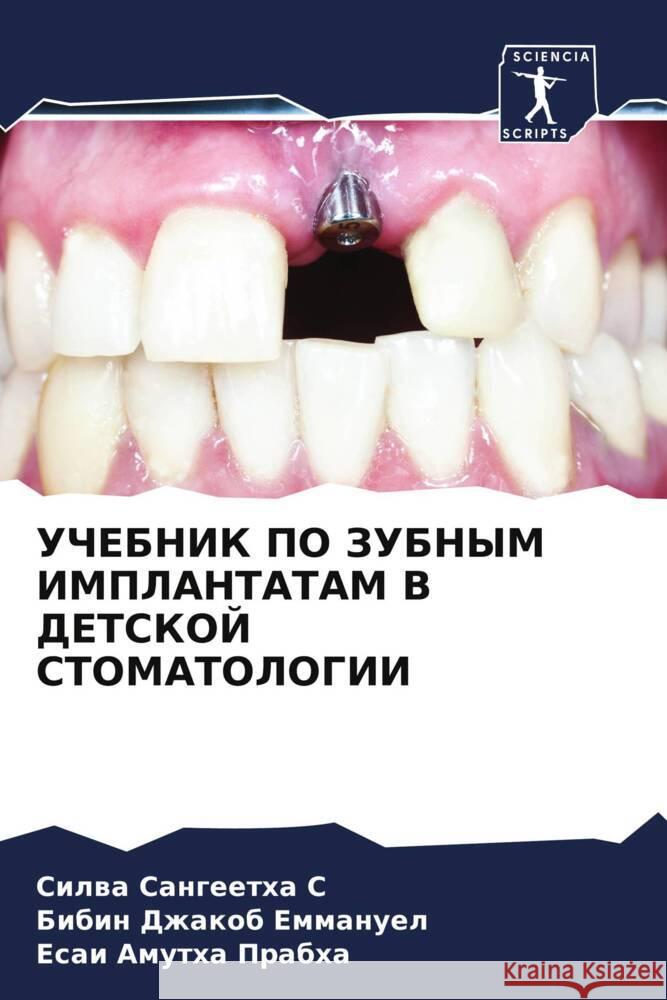 UChEBNIK PO ZUBNYM IMPLANTATAM V DETSKOJ STOMATOLOGII S, Cilwa Sangeetha, Emmanuel, Bibin Dzhakob, Prabha, Esai Amutha 9786204509020