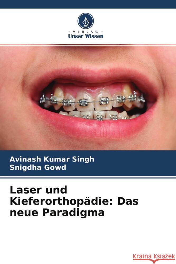 Laser und Kieferorthopädie: Das neue Paradigma Singh, Avinash Kumar, Gowd, Snigdha 9786204510958