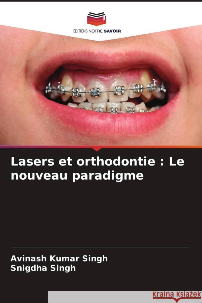 Lasers et orthodontie : Le nouveau paradigme Singh, Avinash Kumar, Singh, Snigdha 9786204510972