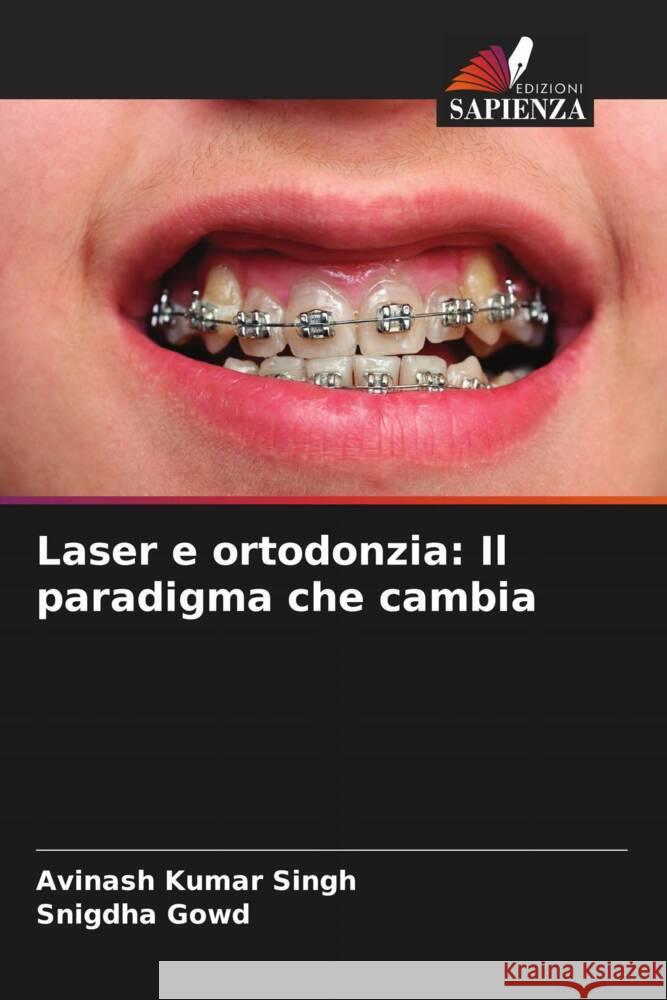 Laser e ortodonzia: Il paradigma che cambia Singh, Avinash Kumar, Gowd, Snigdha 9786204510989