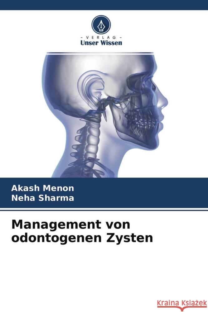 Management von odontogenen Zysten Menon, Akash, Sharma, Neha 9786204515755