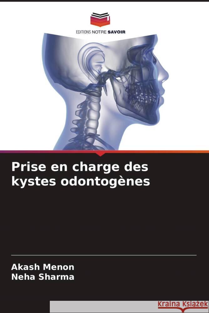 Prise en charge des kystes odontogènes Menon, Akash, Sharma, Neha 9786204515779