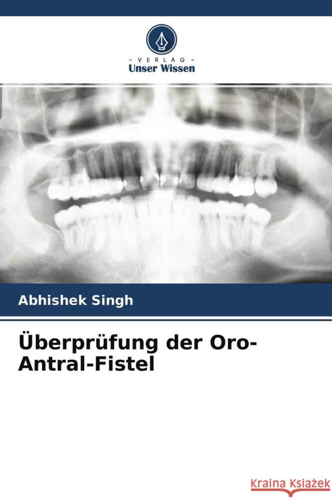 Überprüfung der Oro-Antral-Fistel Singh, Abhishek, Mukul, Sailesh Kumar, Pandey, Arun 9786204518688 Verlag Unser Wissen