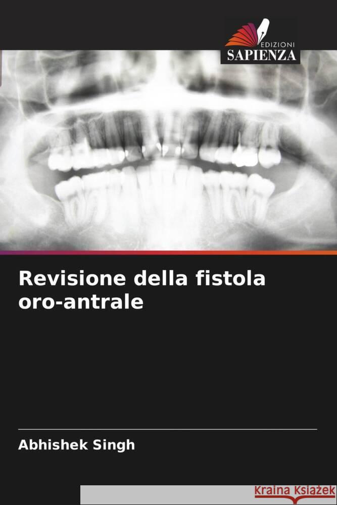 Revisione della fistola oro-antrale Singh, Abhishek, Mukul, Sailesh Kumar, Pandey, Arun 9786204518718