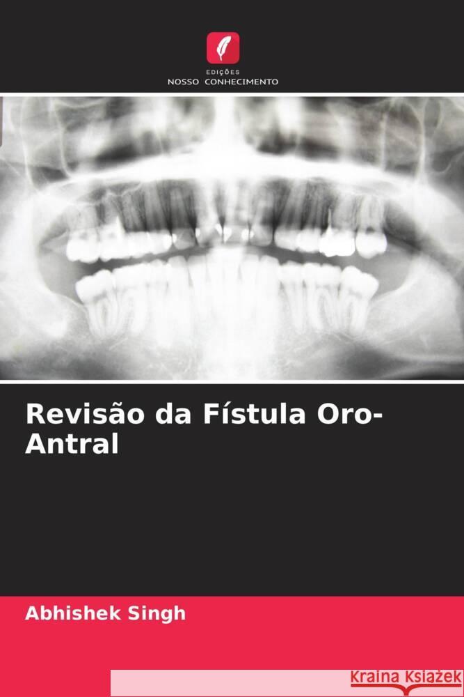 Revisão da Fístula Oro-Antral Singh, Abhishek, Mukul, Sailesh Kumar, Pandey, Arun 9786204518725 Edições Nosso Conhecimento