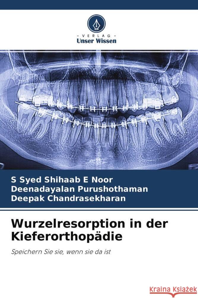 Wurzelresorption in der Kieferorthopädie Noor, S Syed Shihaab E, Purushothaman, Deenadayalan, Chandrasekharan, Deepak 9786204519364