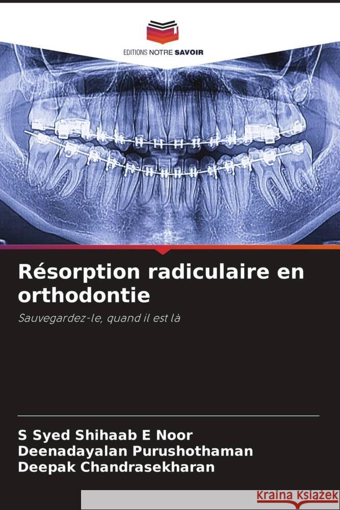 Résorption radiculaire en orthodontie Noor, S Syed Shihaab E, Purushothaman, Deenadayalan, Chandrasekharan, Deepak 9786204519388