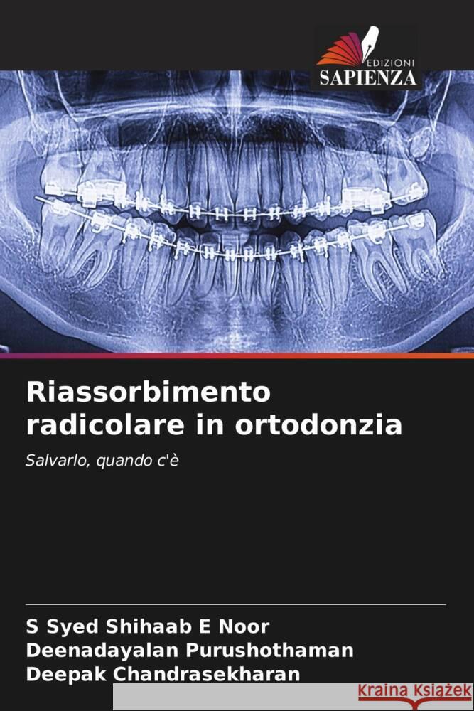 Riassorbimento radicolare in ortodonzia Noor, S Syed Shihaab E, Purushothaman, Deenadayalan, Chandrasekharan, Deepak 9786204519395