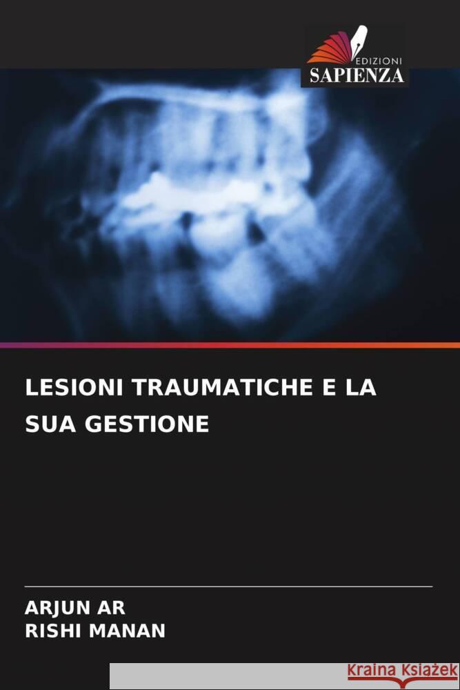 LESIONI TRAUMATICHE E LA SUA GESTIONE AR, Arjun, Manan, Rishi 9786204520285 Edizioni Sapienza