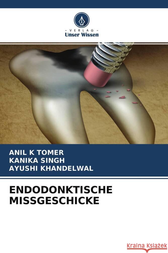 ENDODONKTISCHE MISSGESCHICKE Tomer, Anil K, Singh, Kanika, Khandelwal, Ayushi 9786204521510