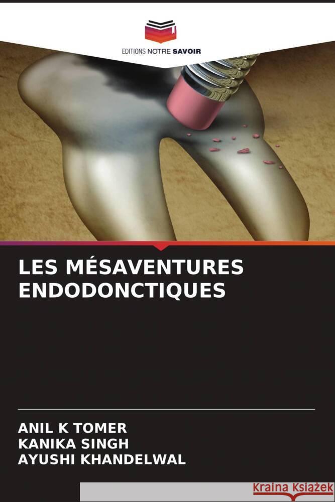 LES MÉSAVENTURES ENDODONCTIQUES Tomer, Anil K, Singh, Kanika, Khandelwal, Ayushi 9786204521596