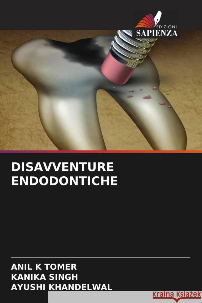 DISAVVENTURE ENDODONTICHE Tomer, Anil K, Singh, Kanika, Khandelwal, Ayushi 9786204521602