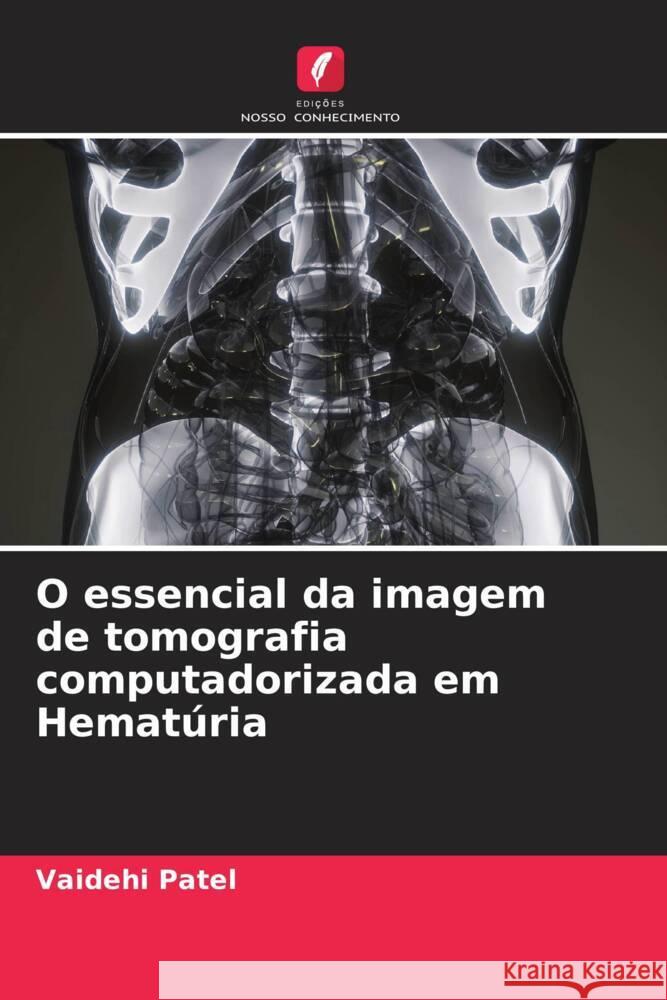 O essencial da imagem de tomografia computadorizada em Hematúria Patel, Vaidehi 9786204522432 Edições Nosso Conhecimento