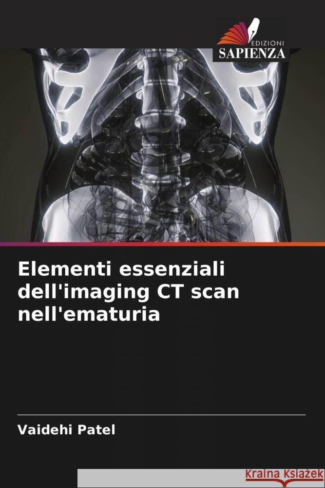 Elementi essenziali dell'imaging CT scan nell'ematuria Patel, Vaidehi 9786204522470 Edizioni Sapienza
