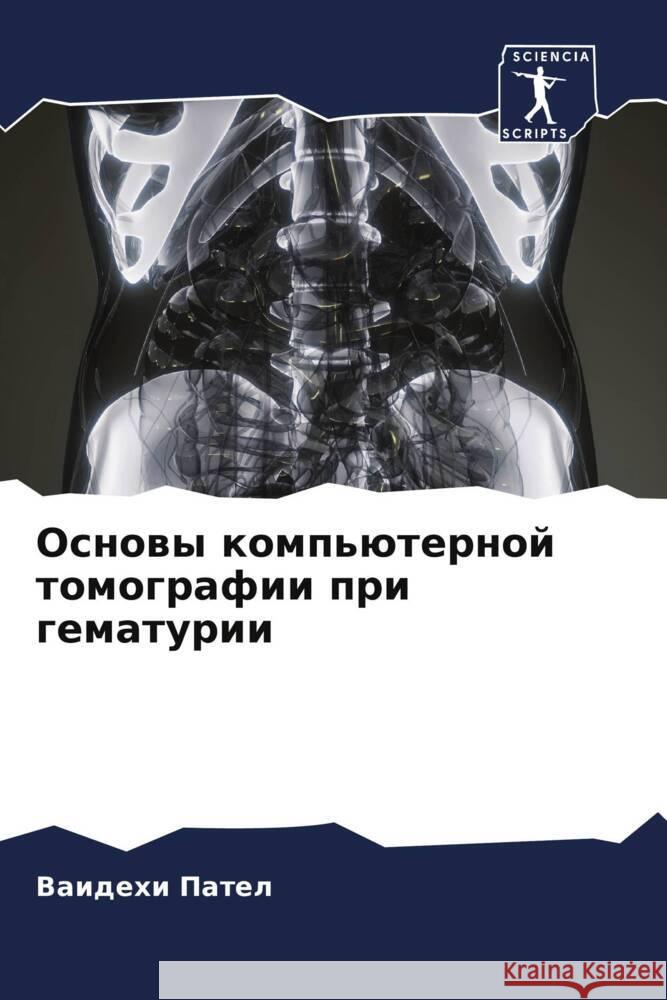 Osnowy komp'üternoj tomografii pri gematurii Patel, Vaidehi 9786204522487 Sciencia Scripts