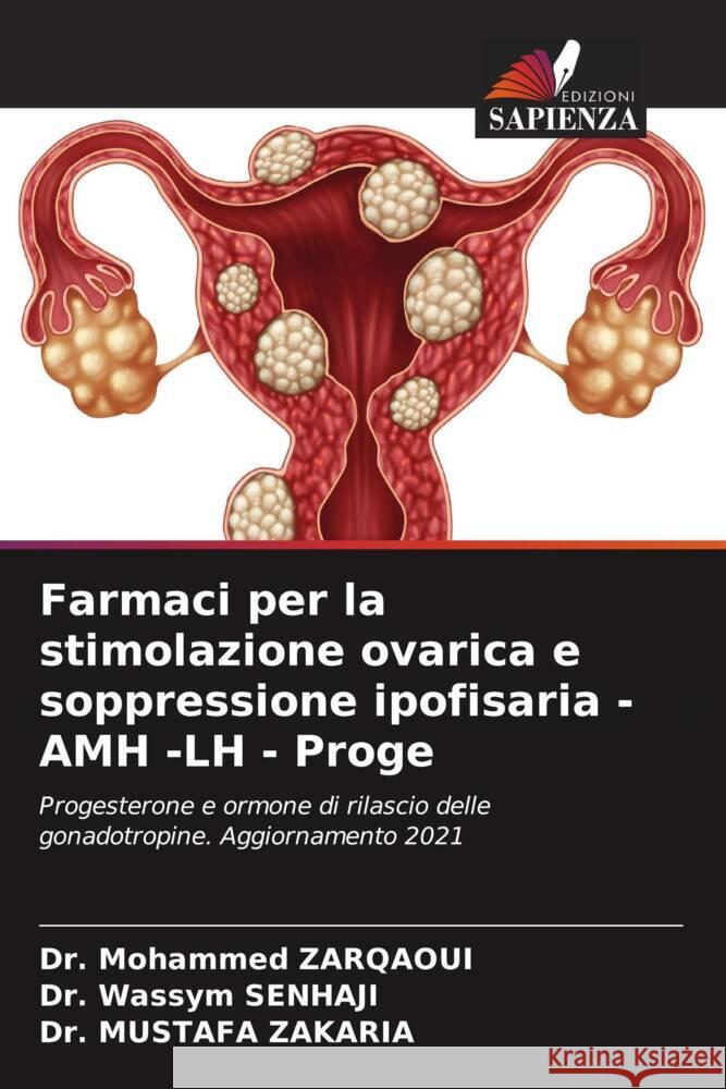 Farmaci per la stimolazione ovarica e soppressione ipofisaria -AMH -LH - Proge Zarqaoui, Dr. Mohammed, SENHAJI, Dr. Wassym, Zakaria, Dr. Mustafa 9786204525877 Edizioni Sapienza