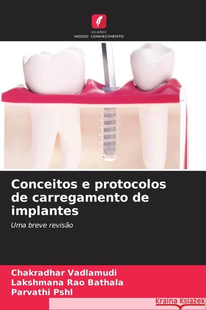 Conceitos e protocolos de carregamento de implantes Vadlamudi, Chakradhar, Bathala, Lakshmana Rao, PSHL, Parvathi 9786204542225