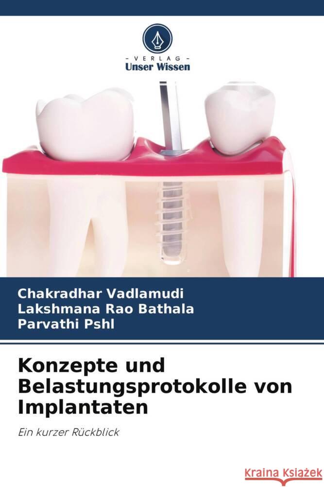 Konzepte und Belastungsprotokolle von Implantaten Vadlamudi, Chakradhar, Bathala, Lakshmana Rao, PSHL, Parvathi 9786204542232