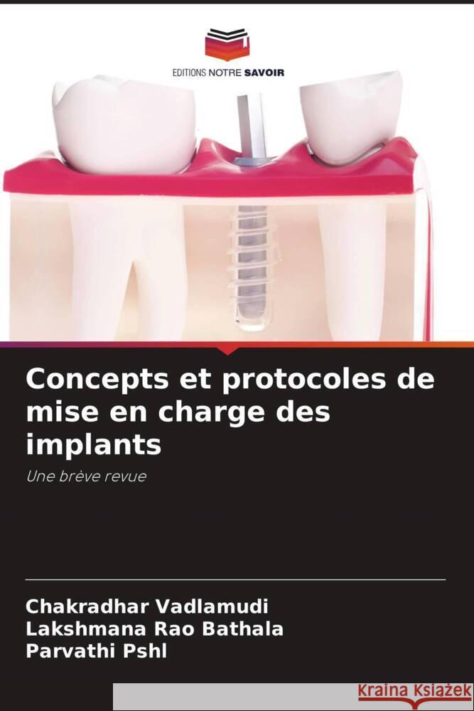 Concepts et protocoles de mise en charge des implants Vadlamudi, Chakradhar, Bathala, Lakshmana Rao, PSHL, Parvathi 9786204542256