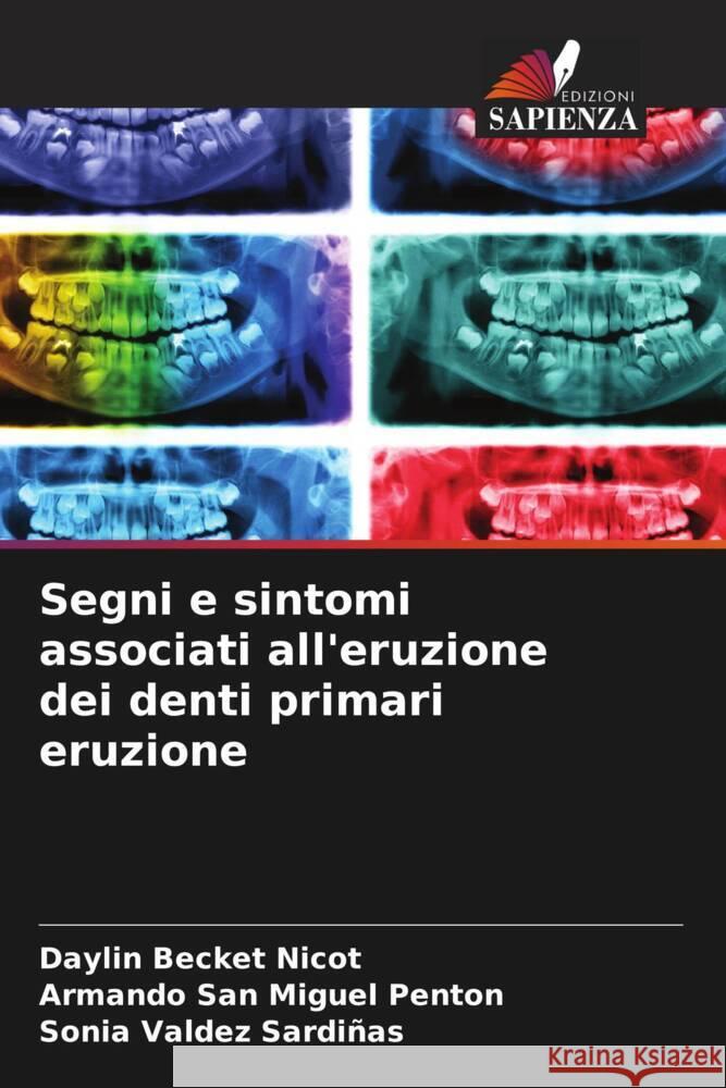 Segni e sintomi associati all'eruzione dei denti primari eruzione Becket Nicot, Daylin, Penton, Armando San Miguel, Valdez Sardiñas, Sonia 9786204551555