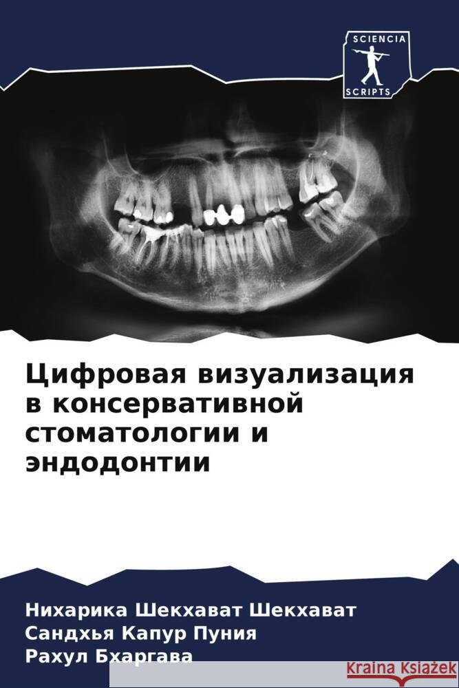 Cifrowaq wizualizaciq w konserwatiwnoj stomatologii i ändodontii Shekhawat, Niharika Shekhawat, Puniq, Sandh'q Kapur, Bhargawa, Rahul 9786204554280