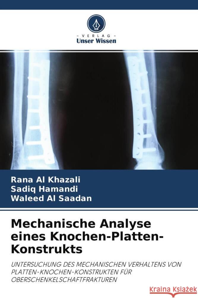 Mechanische Analyse eines Knochen-Platten-Konstrukts Al Khazali, Rana, Hamandi, Sadiq, Al Saadan, Waleed 9786204555614