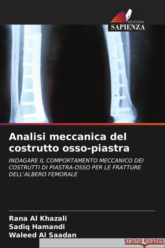 Analisi meccanica del costrutto osso-piastra Al Khazali, Rana, Hamandi, Sadiq, Al Saadan, Waleed 9786204555645