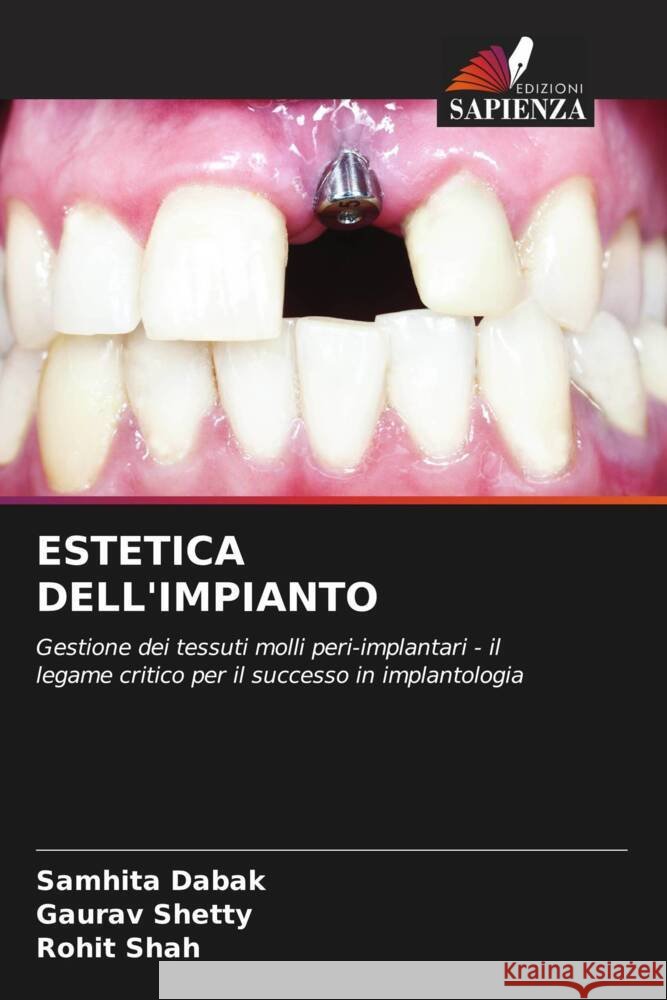 ESTETICA DELL'IMPIANTO Dabak, Samhita, Shetty, Gaurav, Shah, Rohit 9786204560915 Edizioni Sapienza