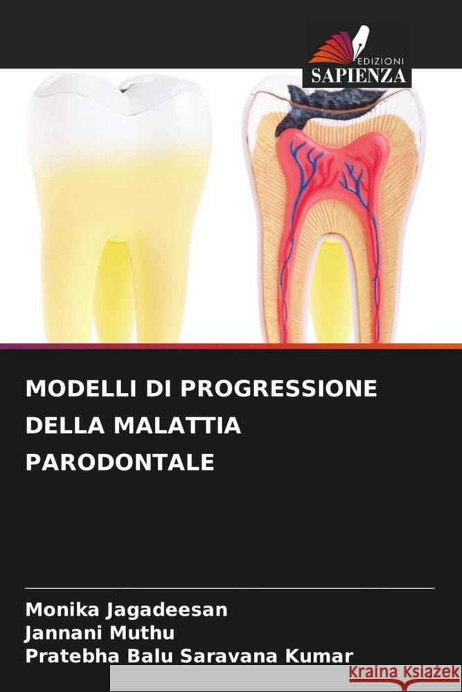 MODELLI DI PROGRESSIONE DELLA MALATTIA PARODONTALE Jagadeesan, Monika, Muthu, Jannani, Saravana Kumar, Pratebha Balu 9786204563855