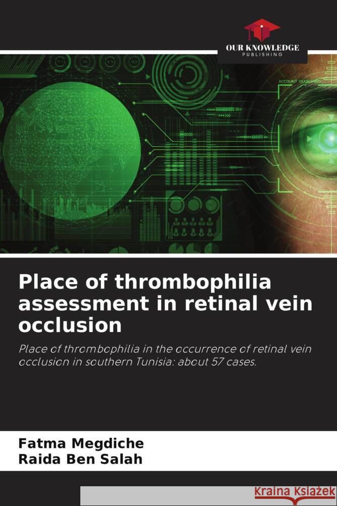 Place of thrombophilia assessment in retinal vein occlusion Megdiche, Fatma, Ben Salah, Raida 9786204564968