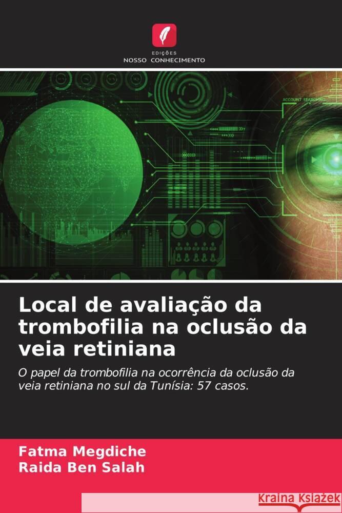 Local de avaliação da trombofilia na oclusão da veia retiniana Megdiche, Fatma, Ben Salah, Raida 9786204564999