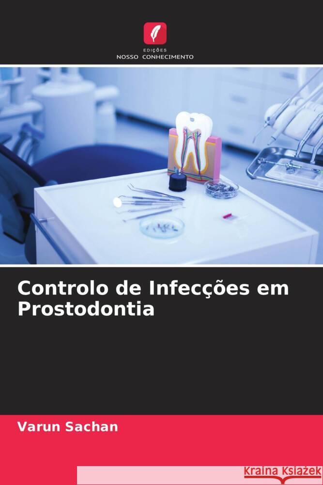 Controlo de Infecções em Prostodontia Sachan, Varun 9786204569475