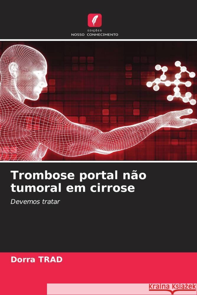 Trombose portal não tumoral em cirrose Trad, Dorra 9786204573311
