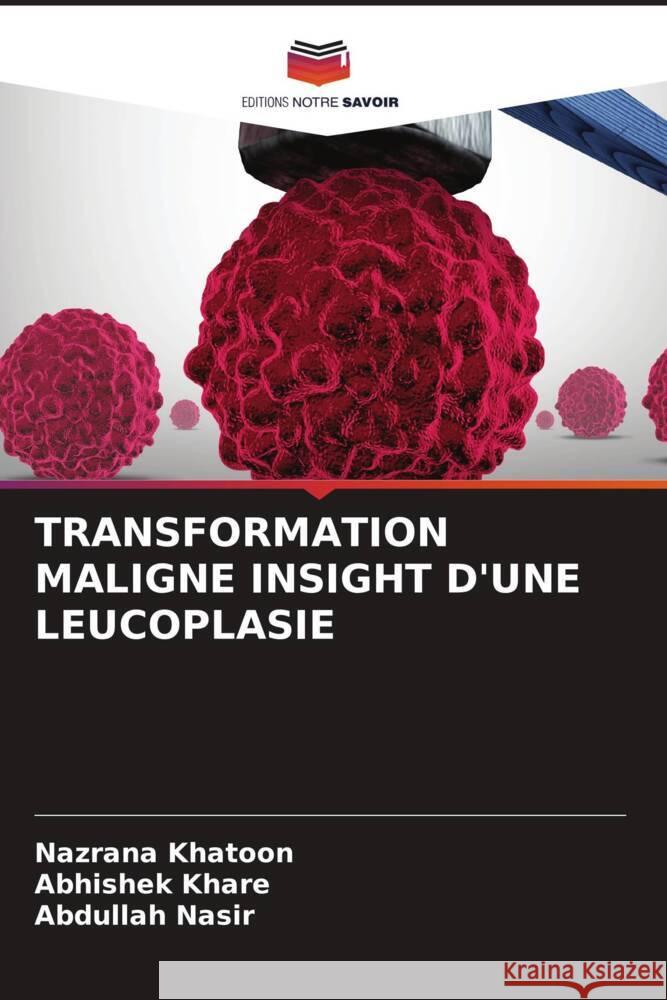 TRANSFORMATION MALIGNE INSIGHT D'UNE LEUCOPLASIE Khatoon, Nazrana, Khare, Abhishek, Nasir, Abdullah 9786204585949 Editions Notre Savoir