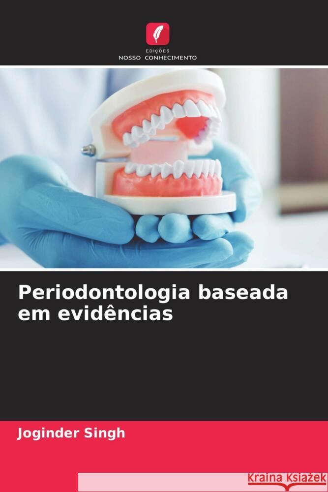 Periodontologia baseada em evidências Singh, Joginder 9786204591360 Edições Nosso Conhecimento