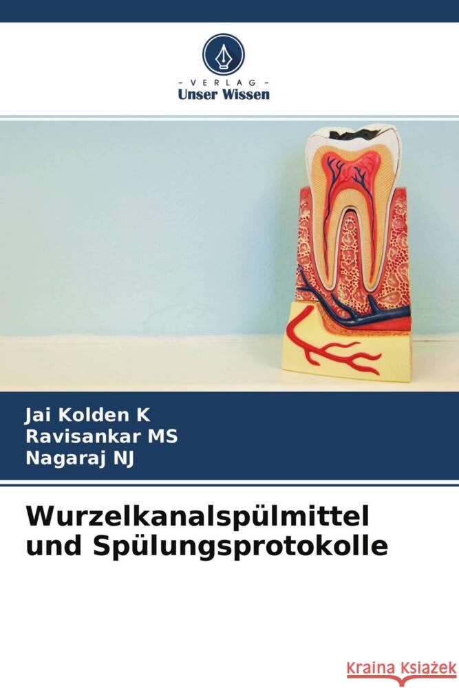 Wurzelkanalspülmittel und Spülungsprotokolle K, Jai Kolden, MS, Ravisankar, NJ, Nagaraj 9786204595931