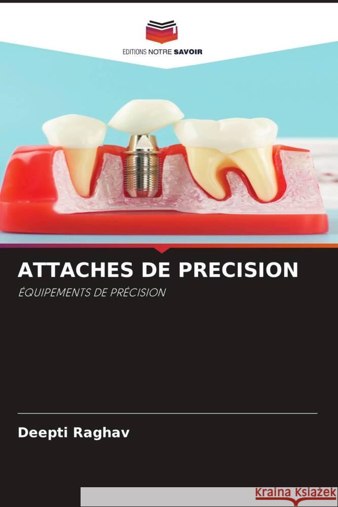 ATTACHES DE PRECISION Raghav, Deepti 9786204608280
