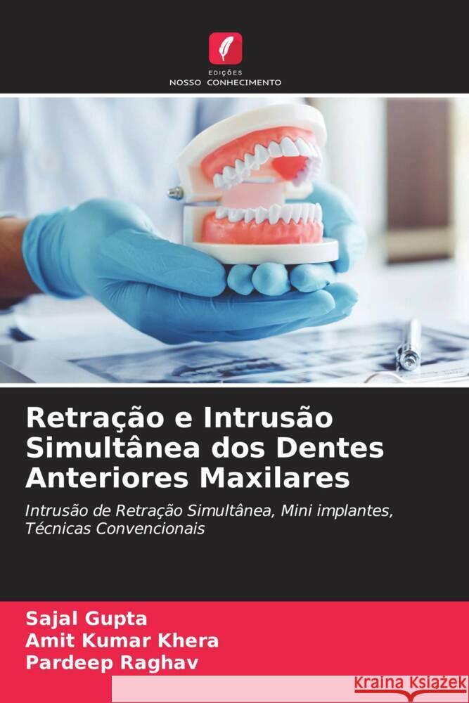 Retração e Intrusão Simultânea dos Dentes Anteriores Maxilares Gupta, Sajal, Khera, Amit Kumar, Raghav, Pardeep 9786204608433